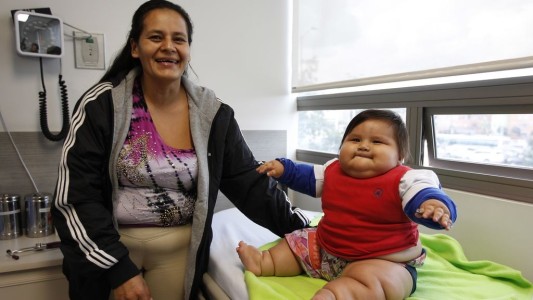Descubren cuál es el problema del bebé colombiano que tiene 8 meses y pesa 20 kilos