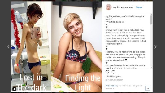 La chica que se curó de la anorexia y ahora difunde información sobre esa enfermedad
