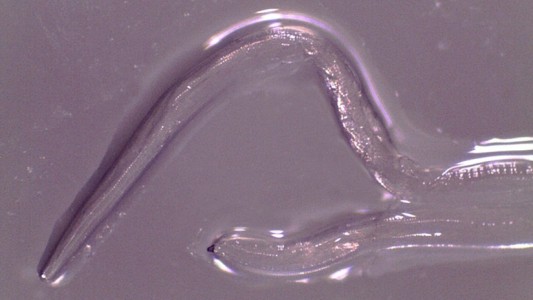 Estados Unidos: extrajeron 14 gusanos del ojo de una mujer