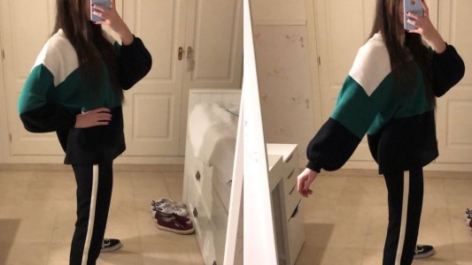 ¿Cuántas piernas ves en esta foto? La ilusión óptica de una chica que es furor en las redes