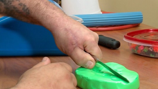 Se cortó un dedo de la mano y le "trasplantaron" uno de su pie