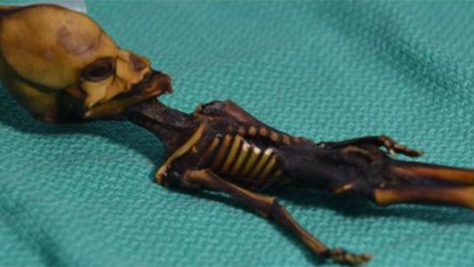 Se resolvió el misterio de "Ata", el falso extraterrestre encontrado en el desierto de Atacama