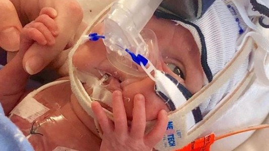 Una madre mostró la increíble recuperación de su hija que nació prematura con medio kilo de peso
