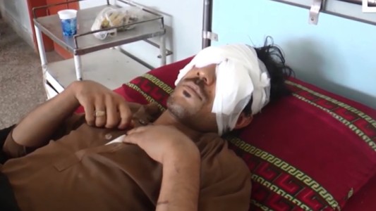 Pakistán: su familia le sacó los ojos con una cuchara porque intentó casarse con su novia sin autorización