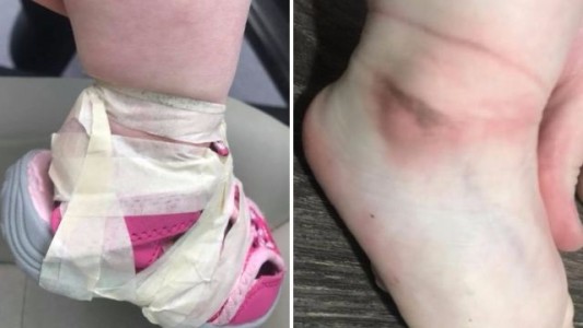 Guardería del terror: le ponen cinta adhesiva en los pies a una nena para que no se le salgan las zapatillas