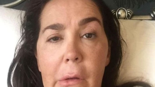 Se inyectó bótox y contrajo una bacteria: ahora sufre parálisis facial y convulsiones