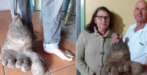 La increíble papa de 8 kilos con forma de pie
