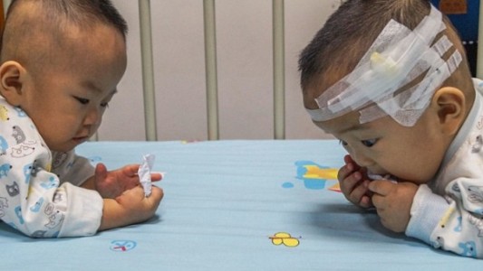 Una pareja china tenía que elegir uno solo de sus mellizos para que siga vivo hasta que llegó la solución
