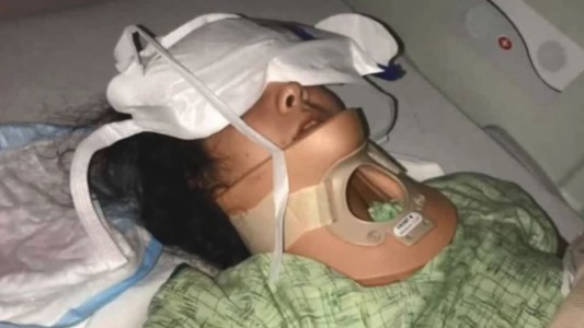 Una adolescente se fracturó el cráneo mientras realizaba el reto viral del momento