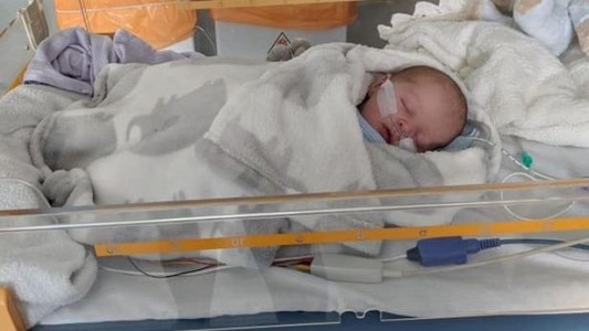 Un bebé estuvo al borde de la muerte al contagiarse herpes por un beso