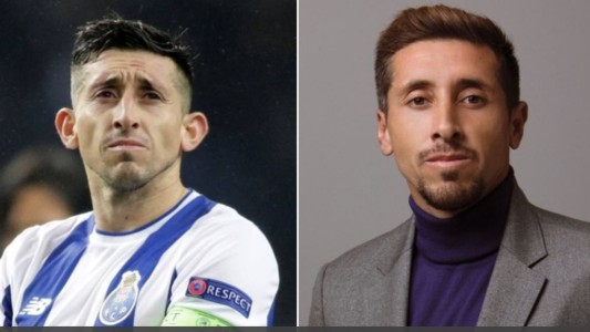 Un futbolista se operó la cara, quedó irreconocible y estallaron los memes