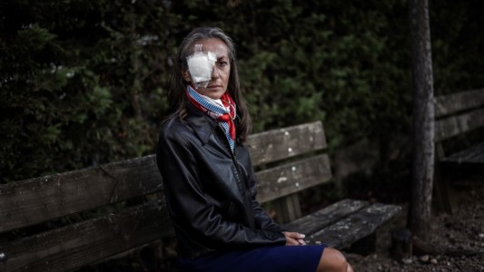 Perdió un ojo al recibir una bola lanzada por el golfista Brooks Koepka