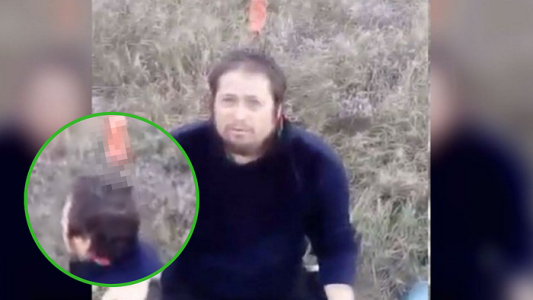 El hombre que se clavó un cuchillo en la cabeza para "poder respirar"