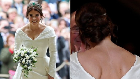 Boda Real: la impactante cicatriz que la princesa Eugenie exhibe sin problemas