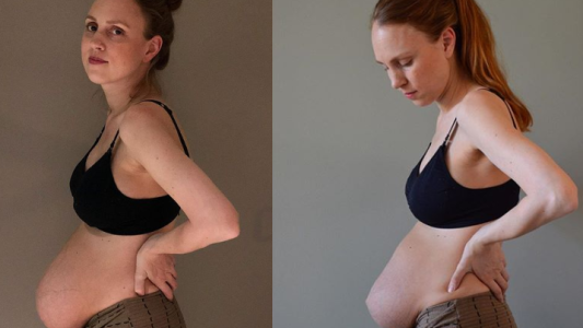 Tuvo trillizos y se volvió viral por mostrar la maternidad con una "mirada realista"