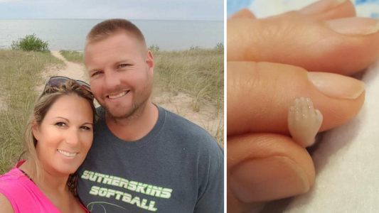 Aborto: una mujer compartió fotos de su feto muerto en Facebook para generar conciencia