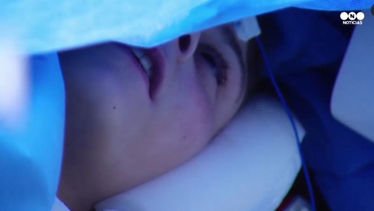 Canta mientras le realizaban una cirugía cerebral