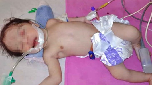 India: una mujer dio a luz al mismo tiempo que se quitaba la vida