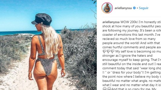 La modelo que se volvió viral por mostrar sus estrías y celulitis al natural