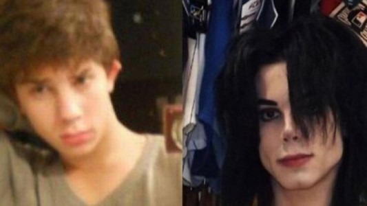 El joven argentino que gastó 33 mil dólares para ser parecido a Michael Jackson
