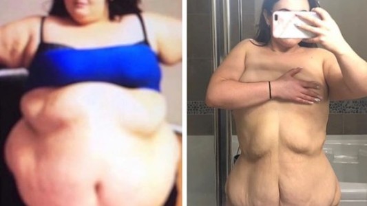 La historia de la joven que bajó 80 kilos: contó su intimidad en Instagram y se volvió viral