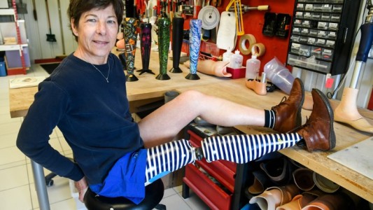 "La gente te mira de forma diferente cuando llevás una prótesis de colores"