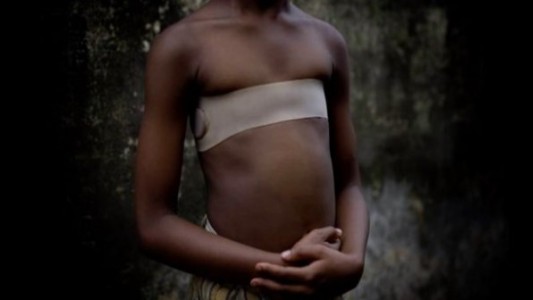 Qué es el "planchado de senos": el método africano para evitar que las nenas sean abusadas