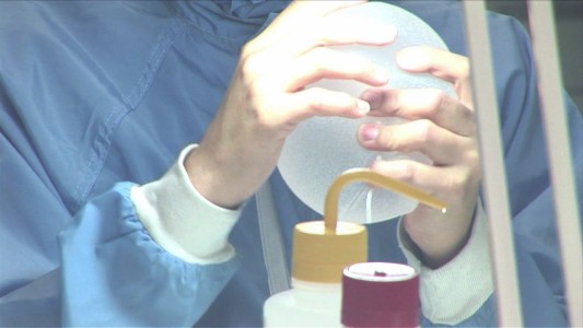 Francia prohíbe modelos de implantes mamarios por riesgo de cáncer