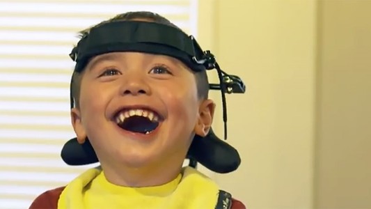 Nueva Zelanda: un nene de 2 años se atragantó con una manzana y quedó paralítico