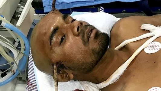 Video escalofriante: un fierro le atravesó la cabeza y sobrevivió de milagro