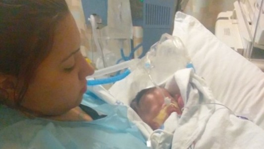 El terrible caso del bebé que nació sin piel en Estados Unidos