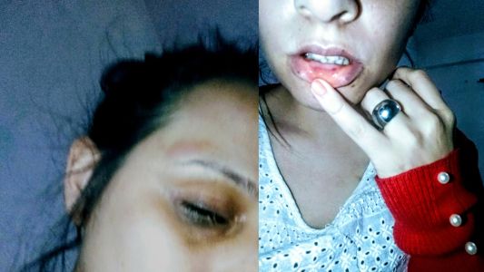 Denunció 11 veces a su ex por violencia de género y no recibe ayuda: “Vivo encerrada y con miedo”