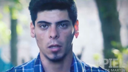 En la piel de Martín, una vida llena de dolor