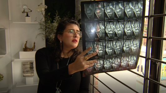 Diseña joyas con plata que extrae de radiografías viejas