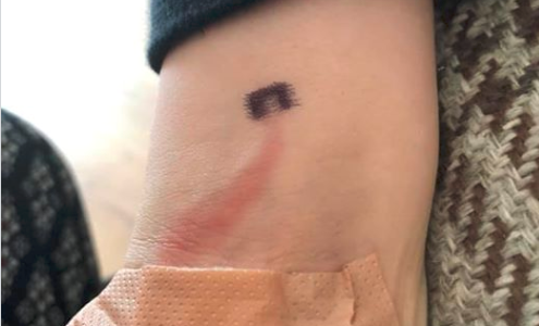 Una madre salvó la vida de su hijo por un detalle de su brazo