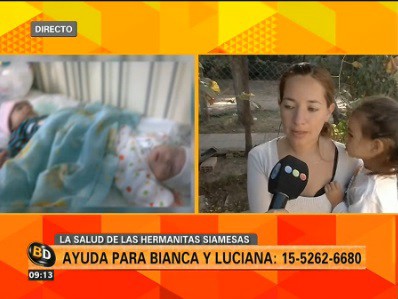 Bianca y Luciana fueron operadas en el Hospital Posadas y necesitan ayuda
