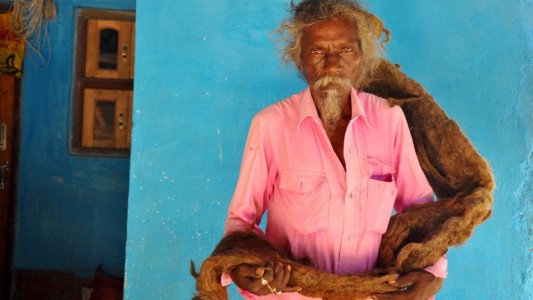 El hombre que lleva 40 años sin lavarse el pelo por "una bendición de Dios"