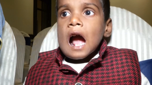 El increíble caso del nene al que le extrajeron 526 dientes