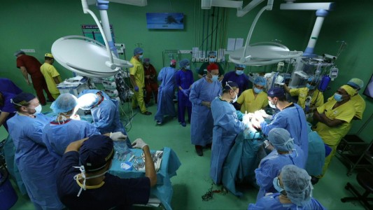 Separan a siamesas unidas por la cabeza en Bangladés