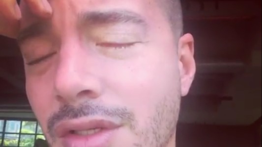 J Balvin habló sobre su trastorno y aconsejó a sus seguidores