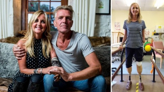 Fue al médico por una tos: le tuvieron que amputar las piernas y un brazo