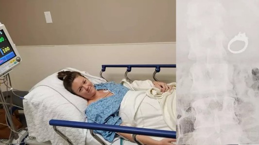 Soñó que se tragaba su anillo de compromiso, despertó y se lo había tragado