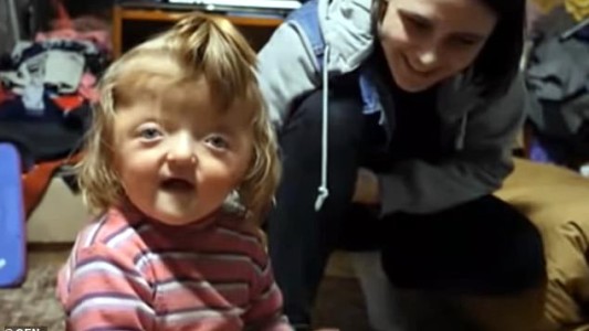 Le prohíben ingresar a un jardín a una nena con el cráneo deformado