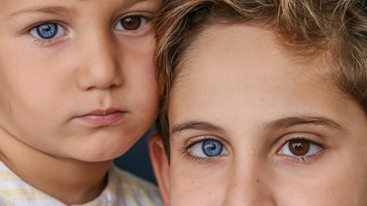 El extraño caso de los hermanos que nacieron con un ojo de cada color
