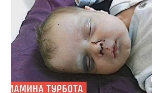 Una mujer golpeó a su bebé de un mes para poder ir a una cita