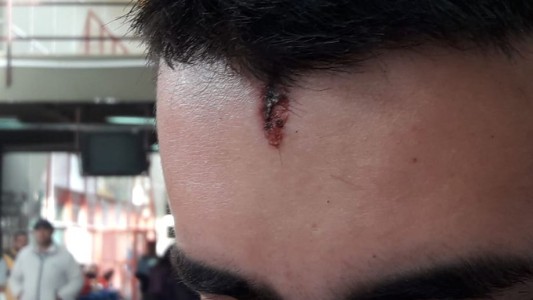 Fue baleado en la cabeza por un remisero y salvó su vida: buscan al autor del disparo