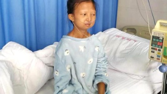 Comió arroz durante 5 años para poder comprarle medicamentos a su hermano enfermo