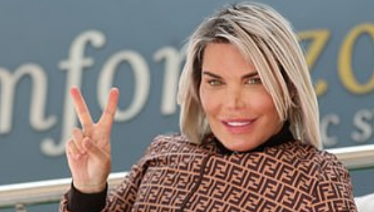 El Ken humano se sacó los implantes de los abdominales y los usó par levantar sus glúteos