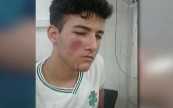 Brutal golpiza a un alumno con una manopla en Barracas: tiene fisura de maxilar