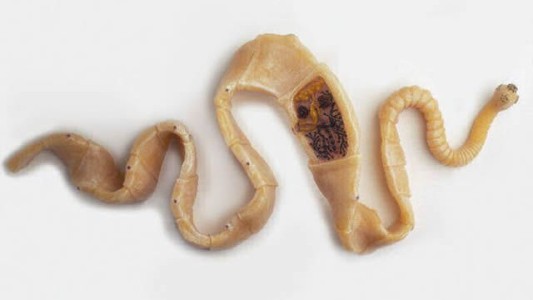 Fue al hospital por un dolor de cabeza y le descubrieron 700 "lombrices solitarias" en el cuerpo